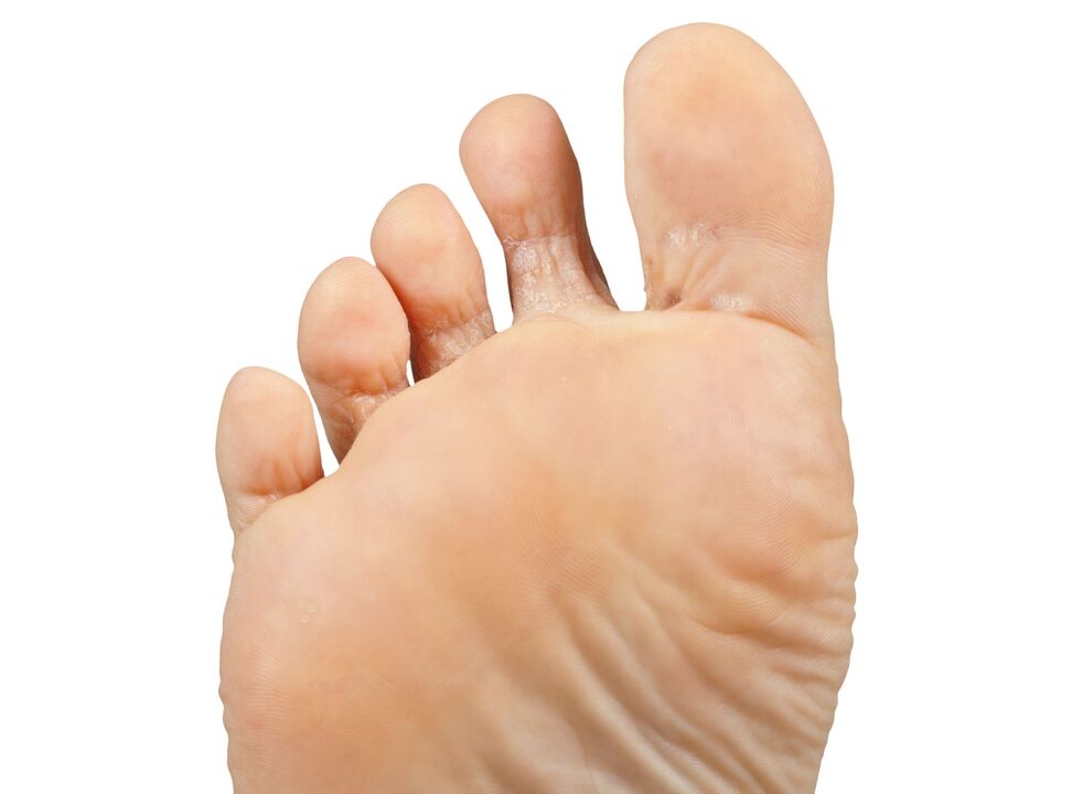 Απομυκιλίλη που κηρύττουν