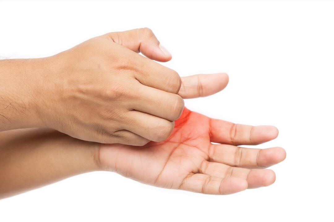 Κνησμός με μανιτάρια και τη θεραπεία του με κρέμα απομάκρυνσης